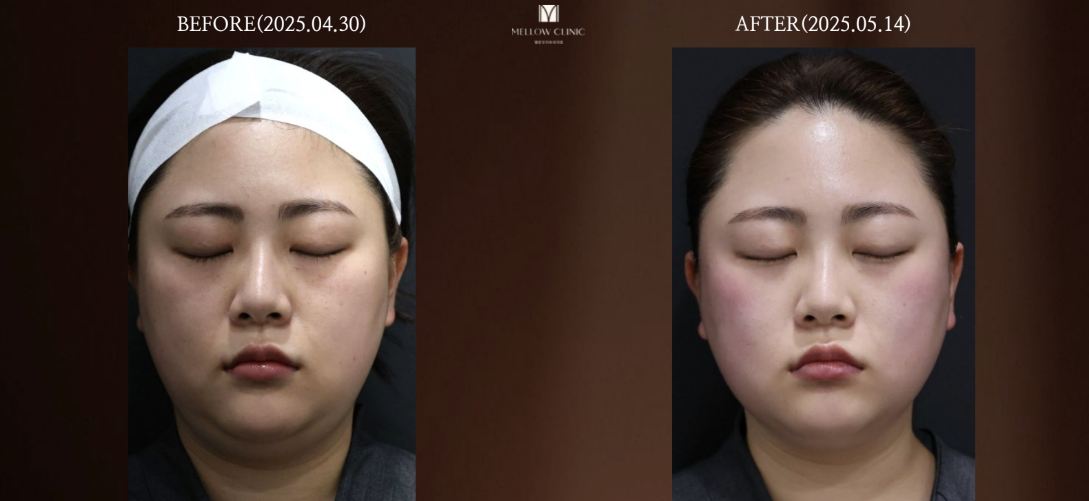 스크린샷 2026-01-21 오전 10.54.17.png