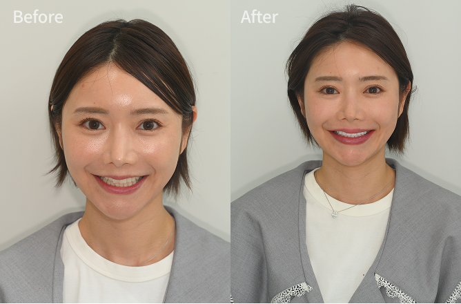 Group 1000003223.png