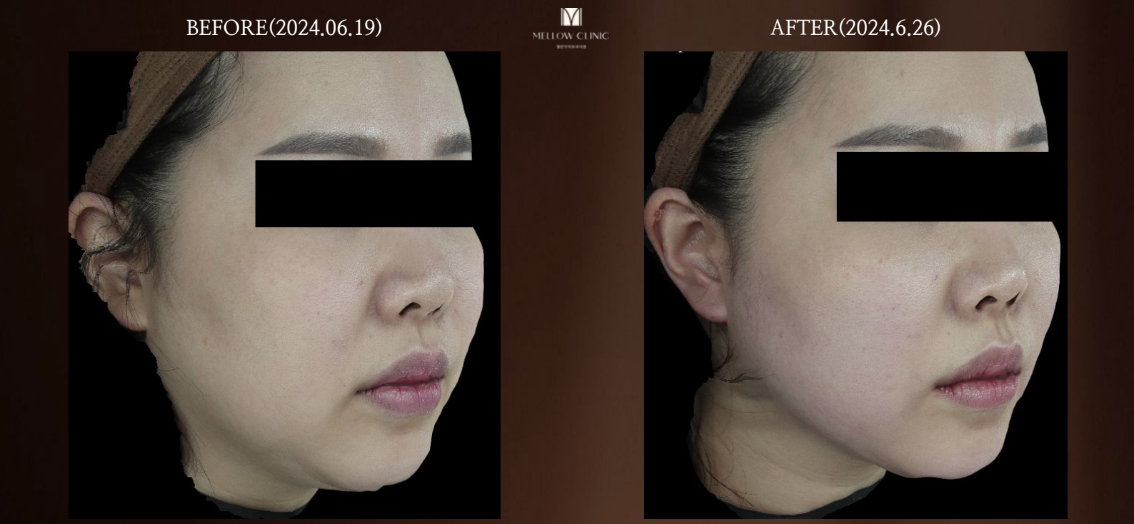 스크린샷 2026-01-21 오전 10.54.01.png