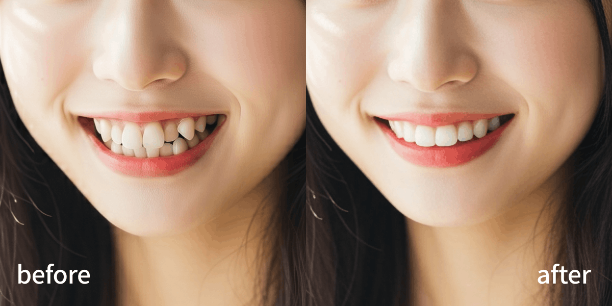 세라믹 B&A.png